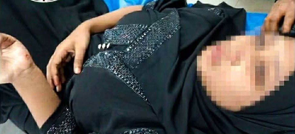 মৌলভীবাজারে উত্ত্যক্তের শিকার হয়ে চলন্ত টমটম থেকে লাফ, কলেজছাত্রীর ২ দাঁত ভাঙল