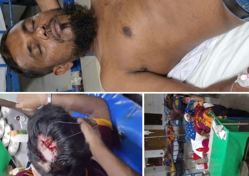 পটুয়াখালীতে হামলার শিকার বিএনপি কর্মী, বিচার চেয়ে থানায় অভিযোগ